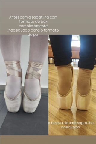 A importância do fitting no ballet